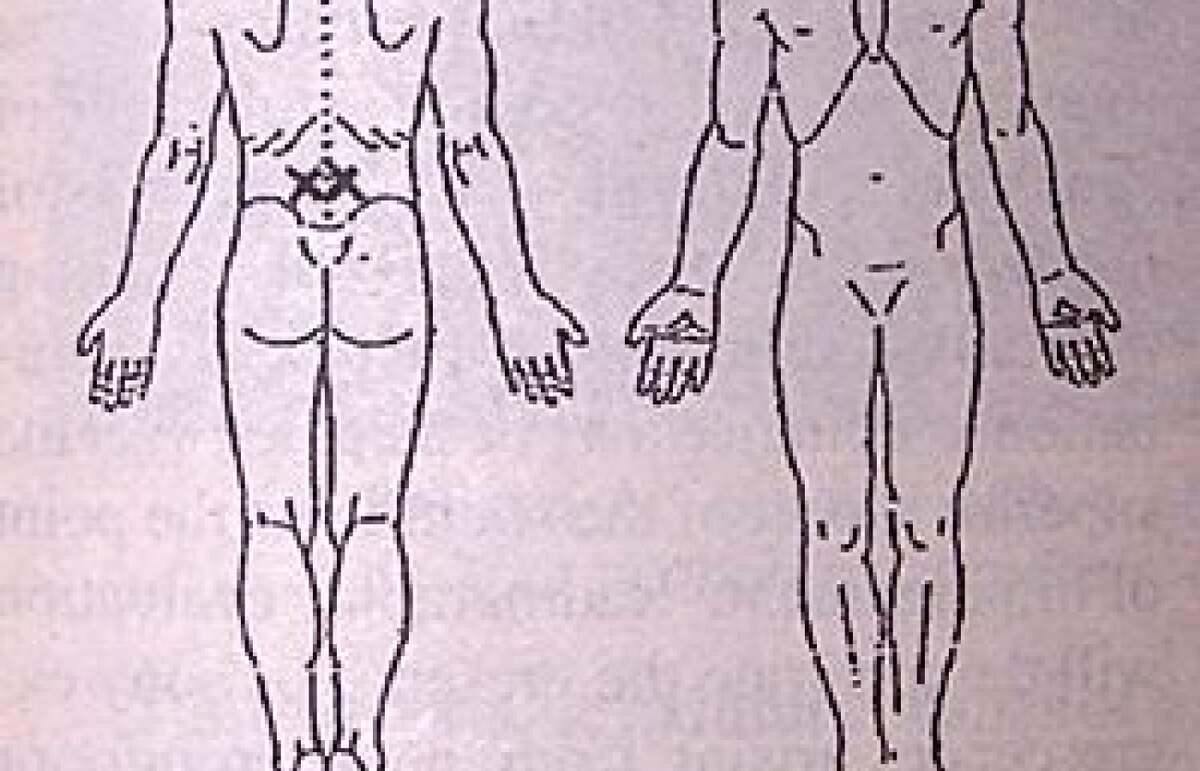 A Closer Look At Pain Drawings Dynamic Chiropractic A Closer Look At Pain Drawings Dynamic Chiropractic