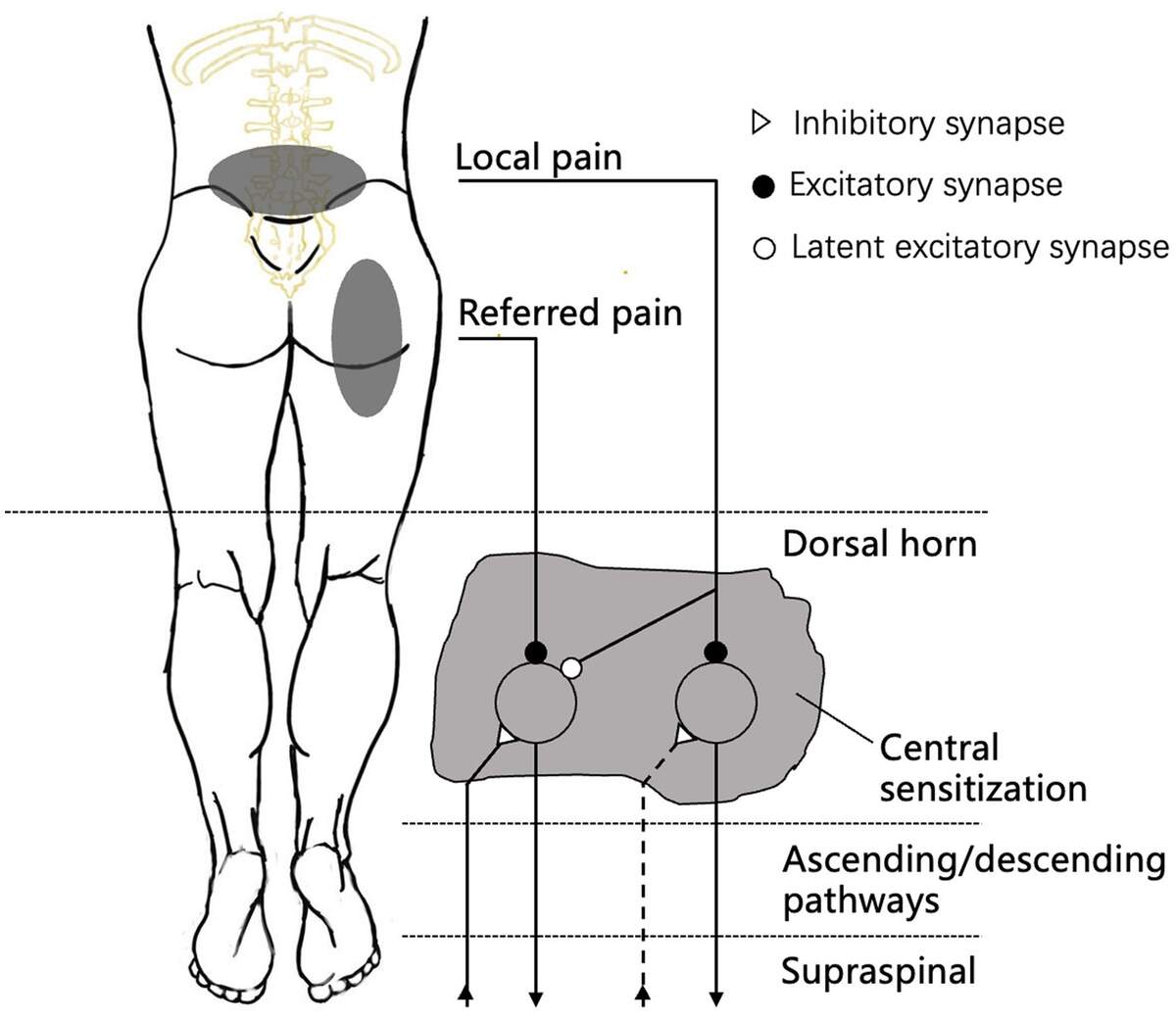 Frontiers Referred Pain Characteristics Possible Mechanisms And Clinical Management