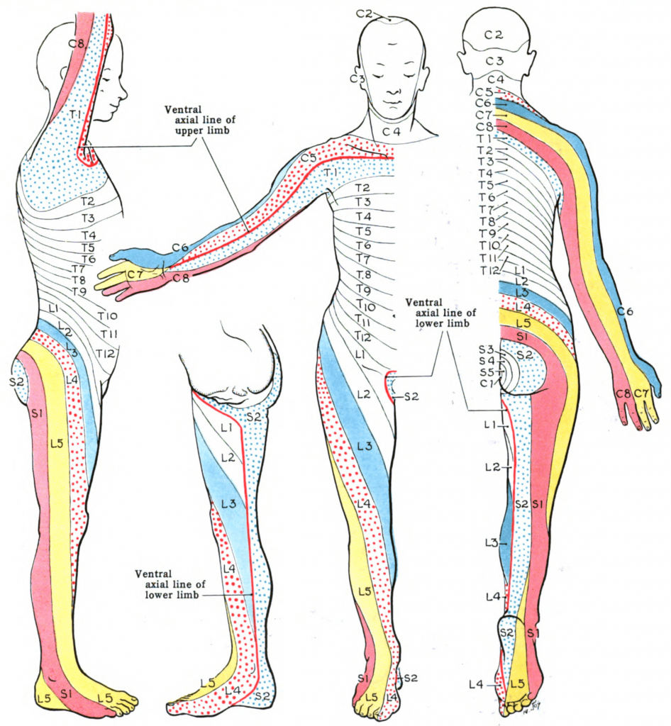 Referred Pain How Can It Hurt Here Yet Be Coming From Somewhere Else
